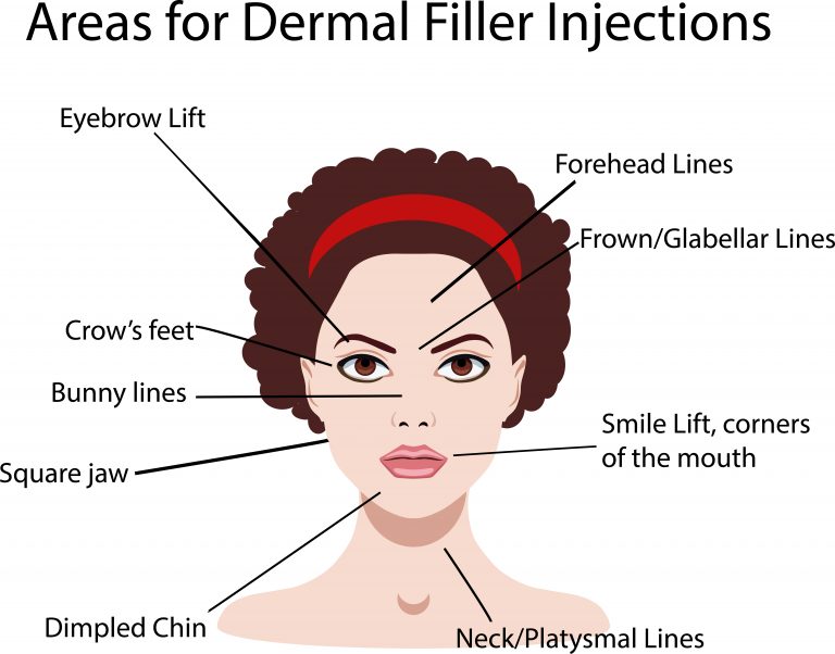 Dermal Fillers